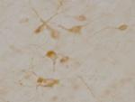 SLC5A7 Antibody in Immunohistochemistry (Paraffin) (IHC (P))