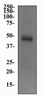 SLC5A7 Antibody in Western Blot (WB)