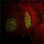 LMO2 Antibody in Immunohistochemistry (Paraffin) (IHC (P))