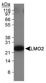 LMO2 Antibody in Western Blot (WB)