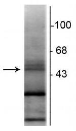 RARB Antibody in Western Blot (WB)