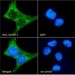 SMN1/SMN2 Antibody in Immunocytochemistry (ICC/IF)