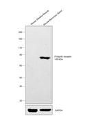 Prolactin Receptor Antibody in Western Blot (WB)