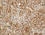 Prolactin Receptor Antibody in Immunohistochemistry (IHC)