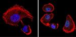 VDR Antibody in Immunocytochemistry (ICC/IF)