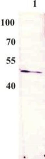 Bovine Papilloma Virus Type 1 E2 Antibody in Western Blot (WB)