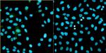 Bovine Papilloma Virus Type 1 E2 Antibody in Immunocytochemistry (ICC/IF)