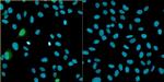 Bovine Papilloma Virus Type 1 E2 Antibody in Immunocytochemistry (ICC/IF)