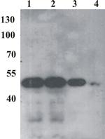 Bovine Papilloma Virus Type 1 E2 Antibody in Western Blot (WB)