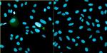 Bovine Papilloma Virus Type 1 E2 Antibody in Immunocytochemistry (ICC/IF)