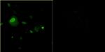 Bovine Papilloma Virus Type 1 E2 Antibody in Immunocytochemistry (ICC/IF)