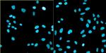 Bovine Papilloma Virus Type 1 E2 Antibody in Immunocytochemistry (ICC/IF)