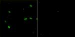 Bovine Papilloma Virus Type 1 E2 Antibody in Immunocytochemistry (ICC/IF)