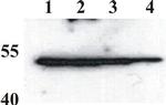 Bovine Papilloma Virus Type 1 E2 Antibody in Western Blot (WB)