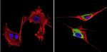 GRK1 Antibody in Immunocytochemistry (ICC/IF)