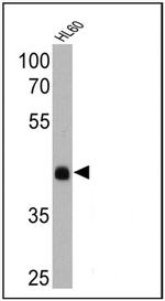 Rhodopsin Antibody in Western Blot (WB)