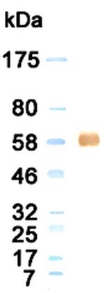 Human Serum Albumin Antibody in Western Blot (WB)