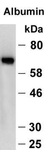 Human Serum Albumin Antibody in Western Blot (WB)