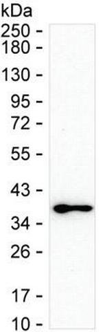 MAPRE3 Antibody in Western Blot (WB)