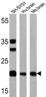 Presenilin 1 Antibody in Western Blot (WB)