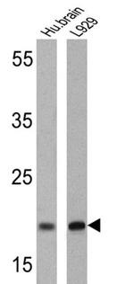 PSEN2 Antibody in Western Blot (WB)