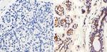 MMP2 Antibody in Immunohistochemistry (Paraffin) (IHC (P))