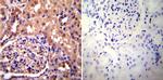 alpha Actinin 4 Antibody in Immunohistochemistry (Paraffin) (IHC (P))