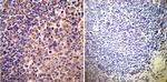 alpha Actinin 4 Antibody in Immunohistochemistry (Paraffin) (IHC (P))