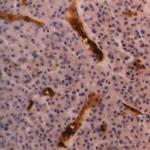 CD235a Antibody in Immunohistochemistry (Paraffin) (IHC (P))