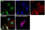 TPX2 Antibody in Immunocytochemistry (ICC/IF)