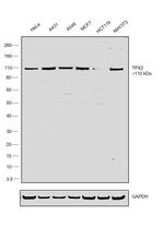 TPX2 Antibody in Western Blot (WB)