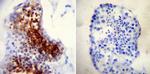 TPX2 Antibody in Immunohistochemistry (Paraffin) (IHC (P))