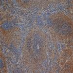 CD3 Antibody in Immunohistochemistry (Paraffin) (IHC (P))