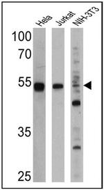 PPAR alpha Antibody in Western Blot (WB)