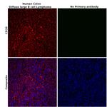 CD20 Antibody in Immunohistochemistry (Paraffin) (IHC (P))