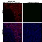 CD20 Antibody in Immunohistochemistry (Paraffin) (IHC (P))