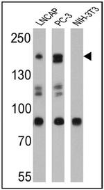 SRC1 Antibody in Western Blot (WB)