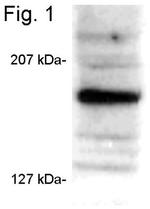 SRC3 Antibody in Western Blot (WB)