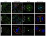 PLK1 Antibody in Immunocytochemistry (ICC/IF)