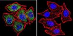 PLK1 Antibody in Immunocytochemistry (ICC/IF)