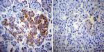 ErbB4 Antibody in Immunohistochemistry (Paraffin) (IHC (P))