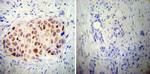 AP2 alpha Antibody in Immunohistochemistry (Paraffin) (IHC (P))