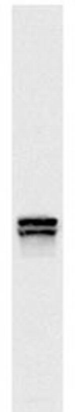 Lys20/Lys21 Antibody in Western Blot (WB)