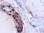 Calcitonin Antibody in Immunohistochemistry (Paraffin) (IHC (P))