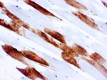 Myosin Skeletal Muscle Antibody in Immunohistochemistry (Paraffin) (IHC (P))