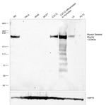 Myosin Skeletal Muscle Antibody in Western Blot (WB)