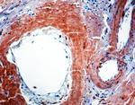 beta Amyloid Antibody in Immunohistochemistry (Paraffin) (IHC (P))