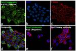 Cytokeratin Pan Antibody in Immunocytochemistry (ICC/IF)