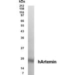 Hepatitis C Virus NS4 Antibody in Western Blot (WB)