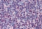 Active/Pro-Caspase 3 Antibody in Immunohistochemistry (Paraffin) (IHC (P))